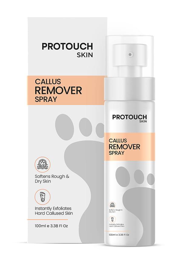 Callus Remover Spray | Potent Formula to Remove the Tough Dead skin
