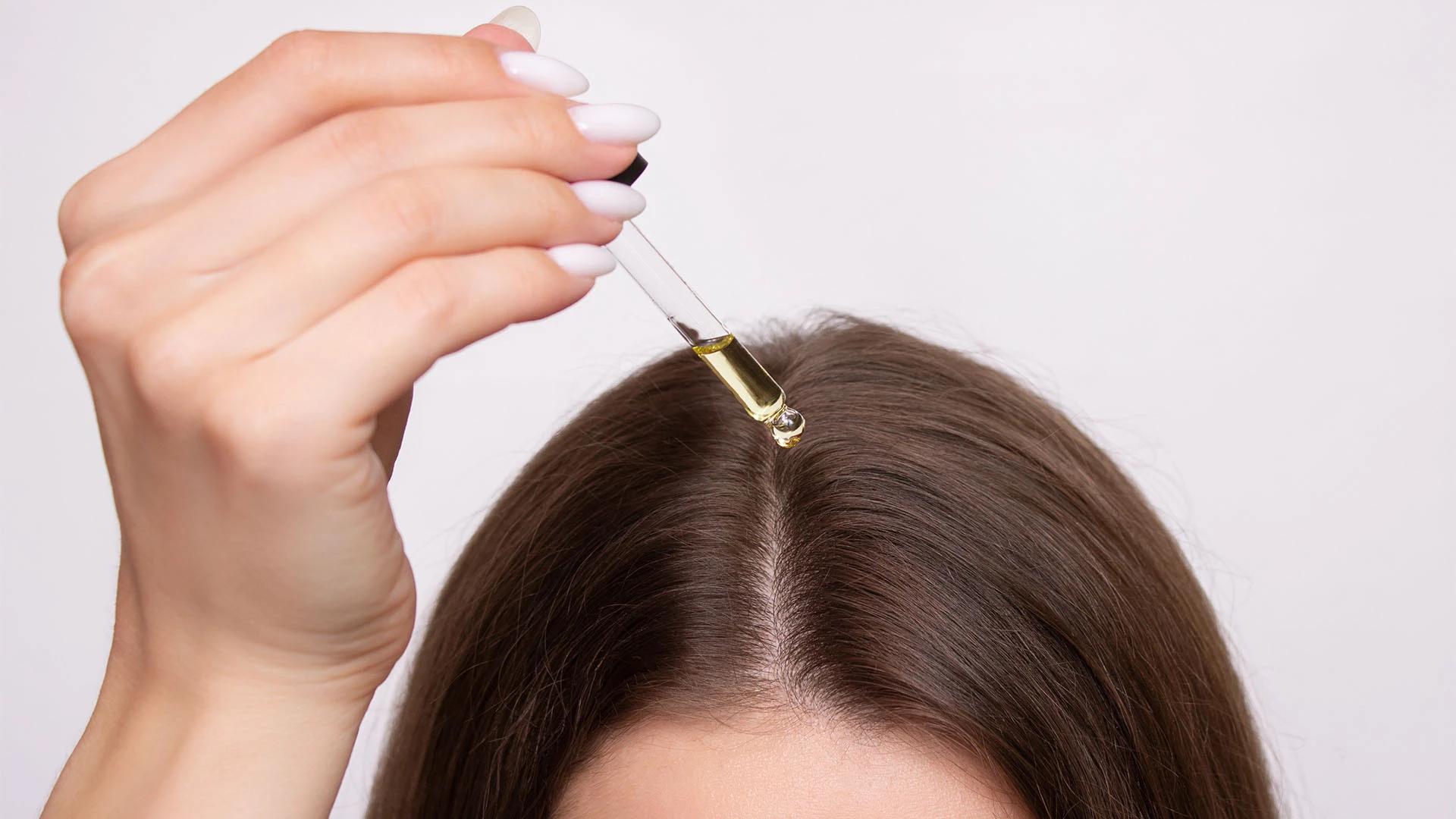 Expert Insights: Home Remedies for Dandruff That Work