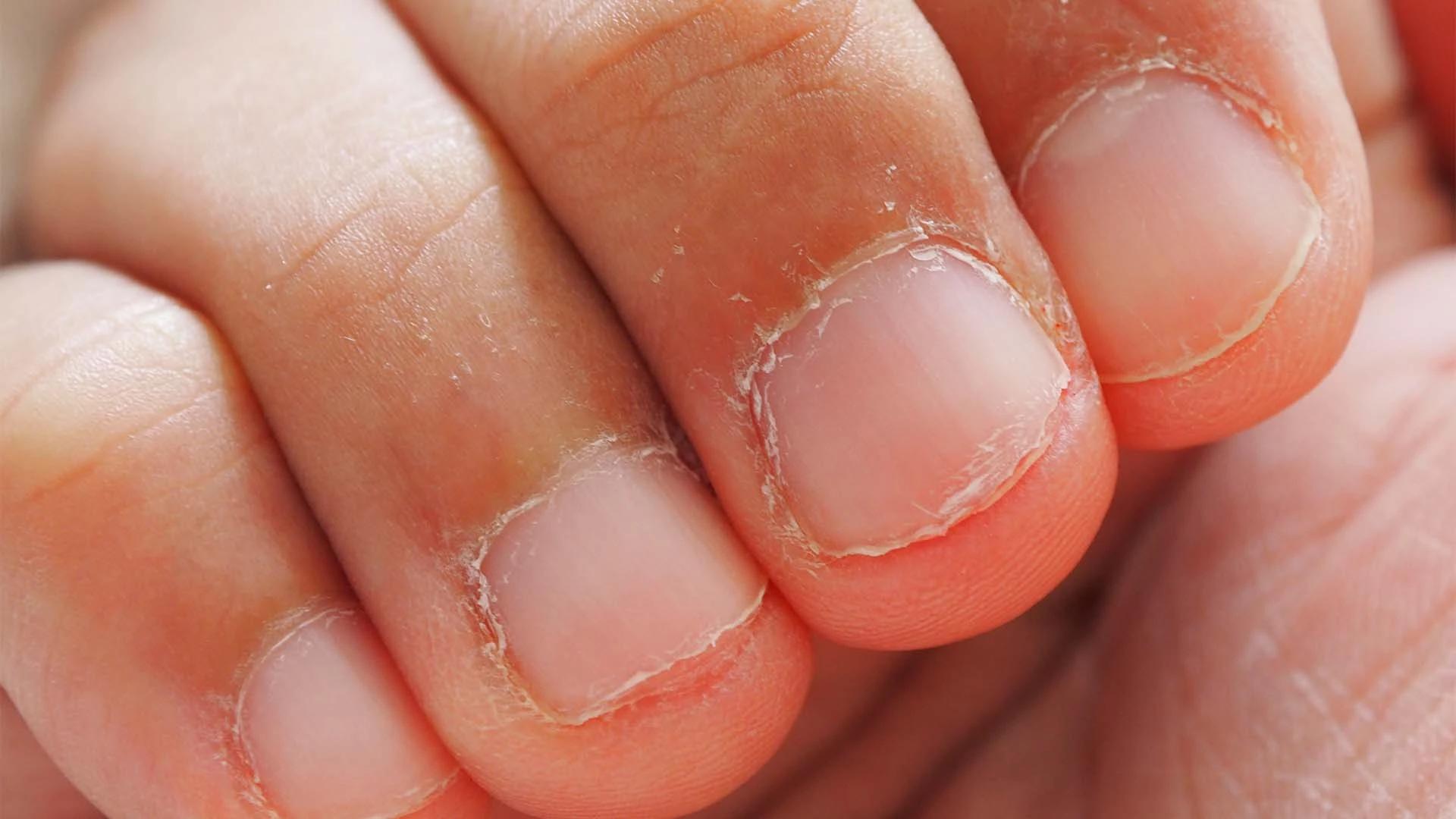 7 Expert Ways to Heal Your Damaged Skin Barrier