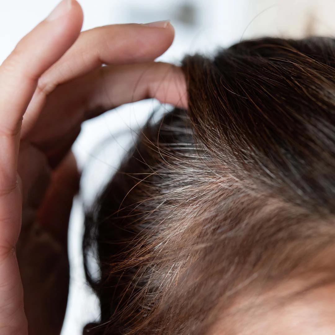 7 Proven Hair Growth Tips for Thin Hair Revealed