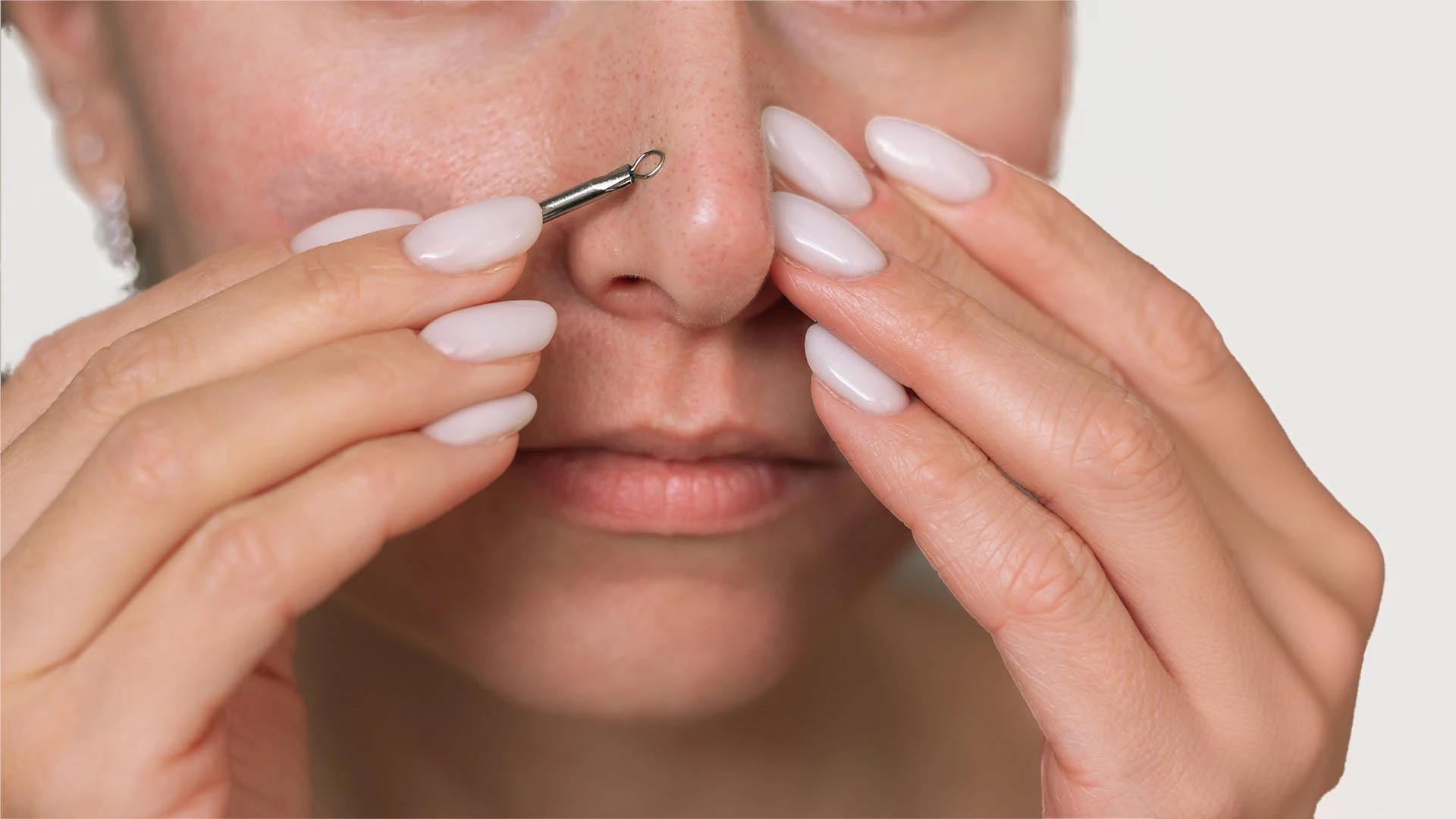7 Proven Tips to Banish Whiteheads on Nose for Good