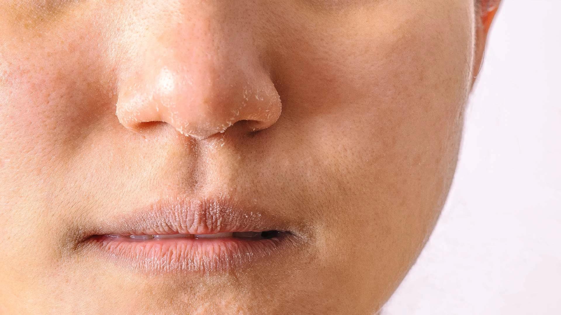 7 Surprising Causes of Dry Skin You Must Know