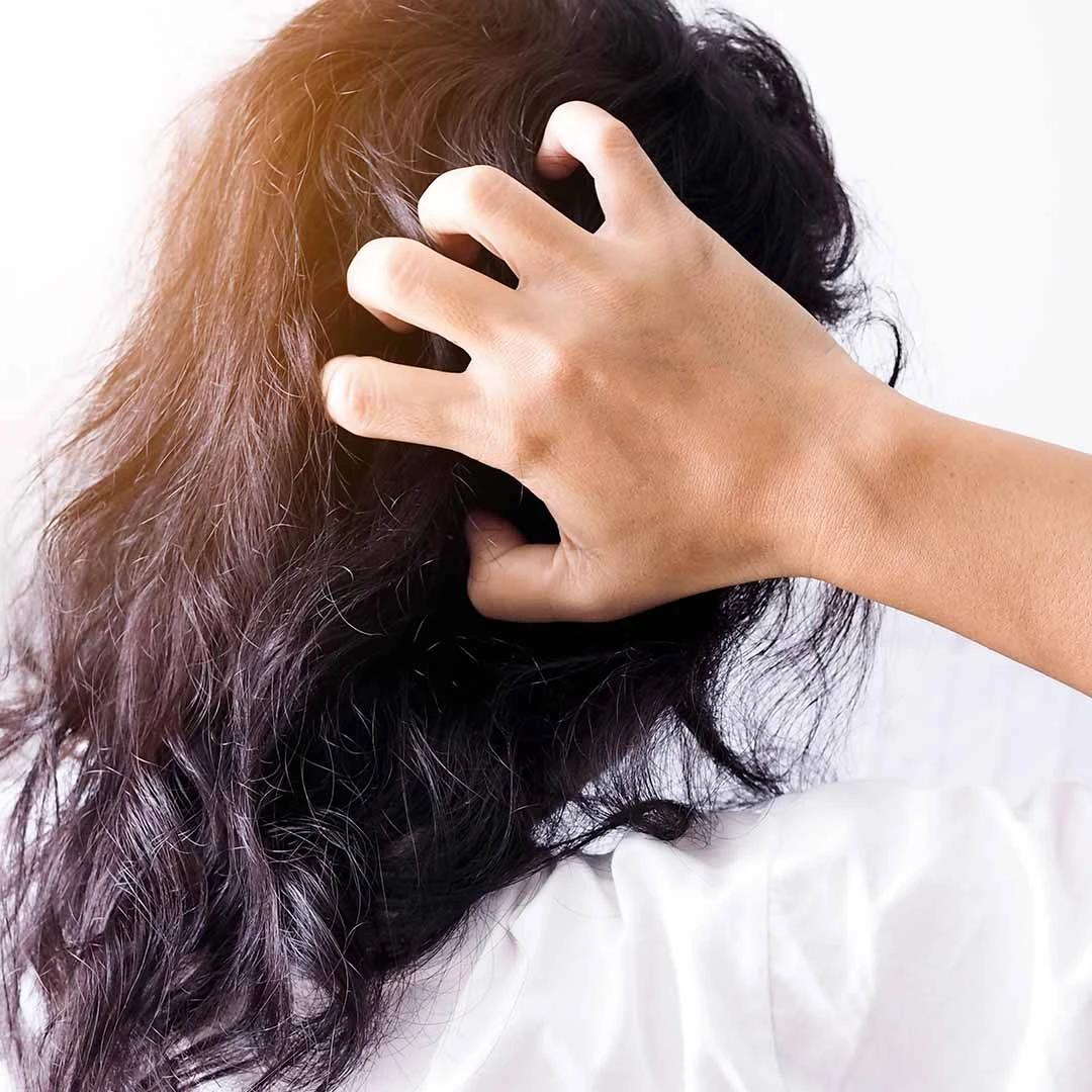 8 Best Anti Dandruff Shampoos for Flaky, Itchy Scalp