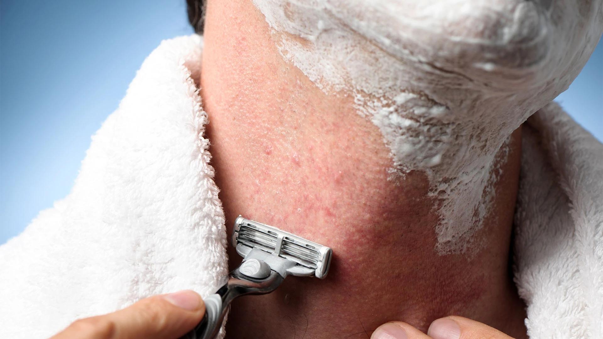 9 Gentle Aftershaves for Sensitive Skin Relief