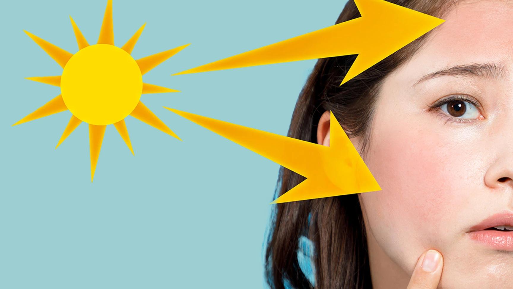 9 Top Rated Products for Sunburnt Skin Relief