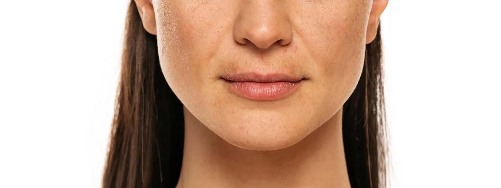 9 Ways be bodywise Pigmentation Repair Cream Tackles Dark Spots