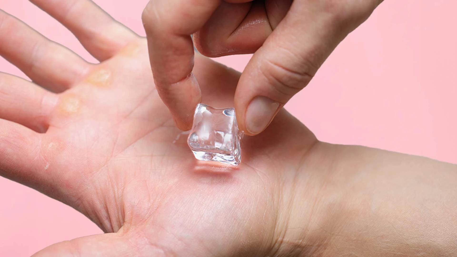 How to Use Ice for Glowing Skin: A Step-by-Step Guide