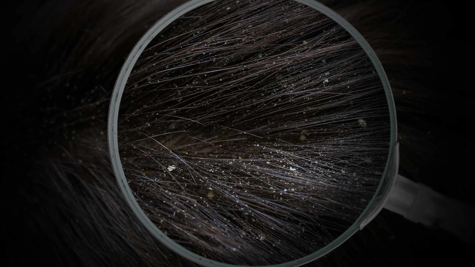 Hair Mask for Dry Hair FAQ: Your Questions Answered
