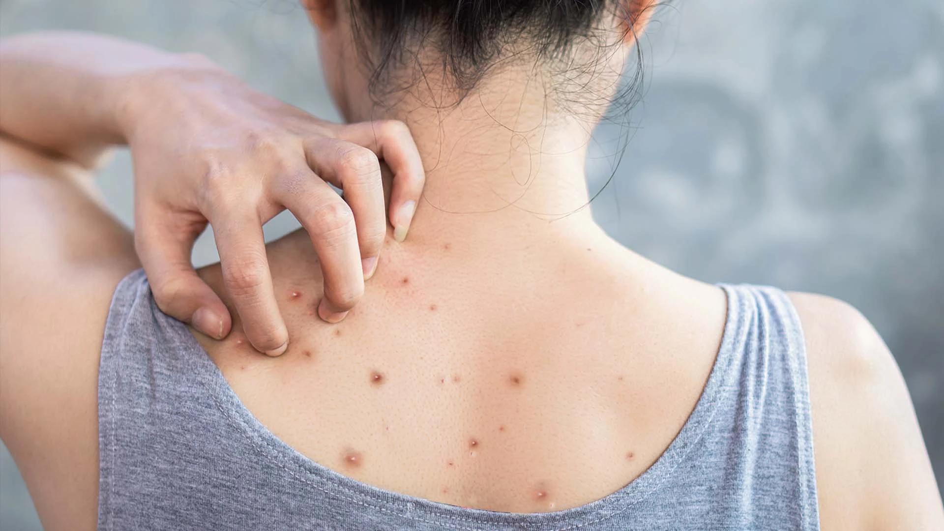 How to Use the Retinol Sandwich Method Safely