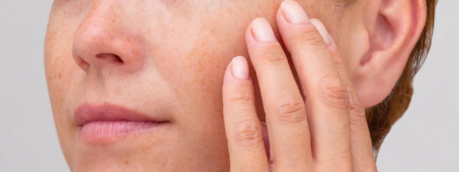 How Perimenopause Impacts Indian Women's Skin Texture & Hydration