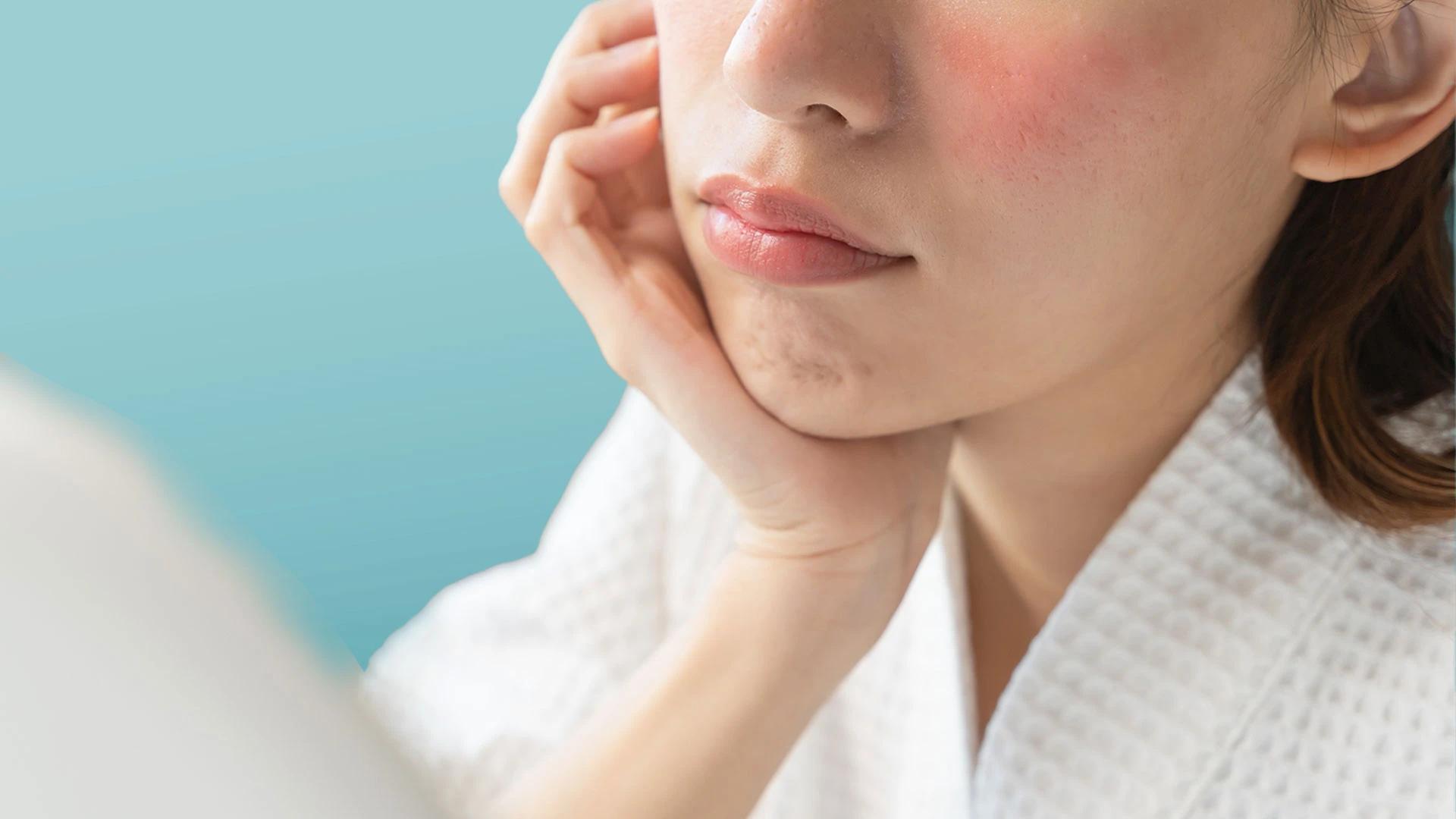 How to Calm Irritated Skin Quickly: Fast Relief Guide