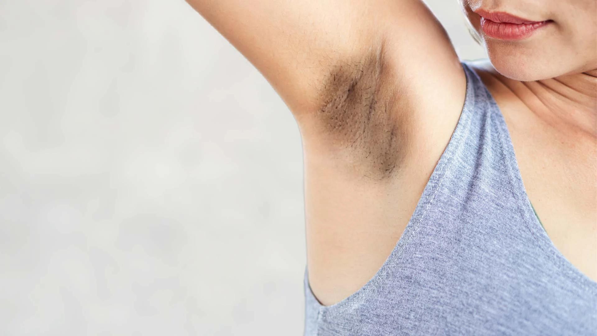 How to Choose the Best Underarm Cream for Brightening