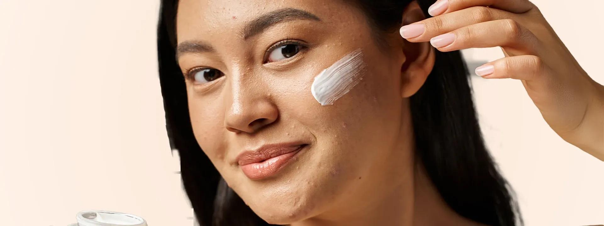 How to Choose the Perfect Acne Treatment Cream