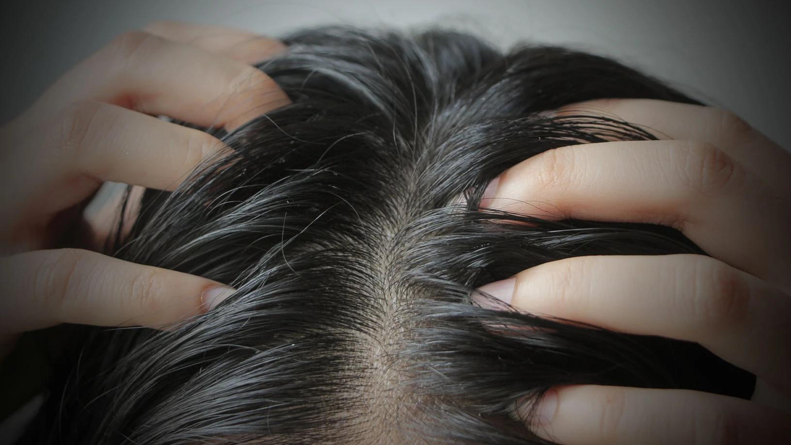 How to Identify the Root Causes of Flaky Scalp