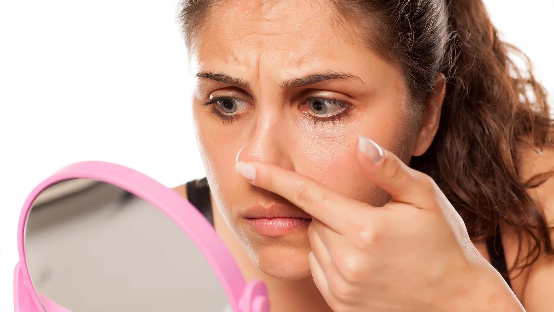 How to Remove Pigmentation on Nose: Expert Tips