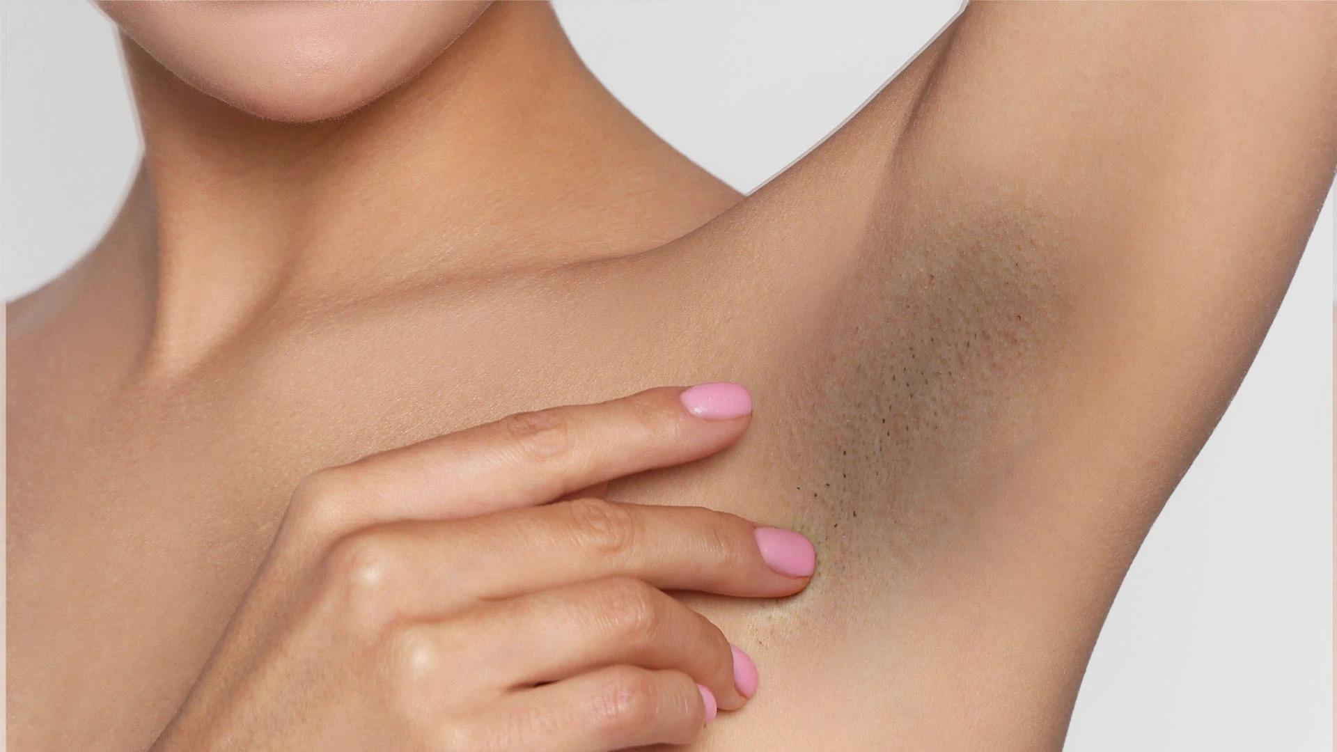 How to Remove Underarm Hair Permanently at Home Naturally