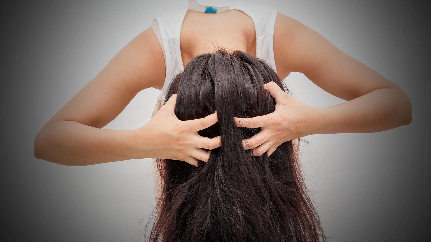 How to Soothe Scalp Irritation from Hair Products Fast