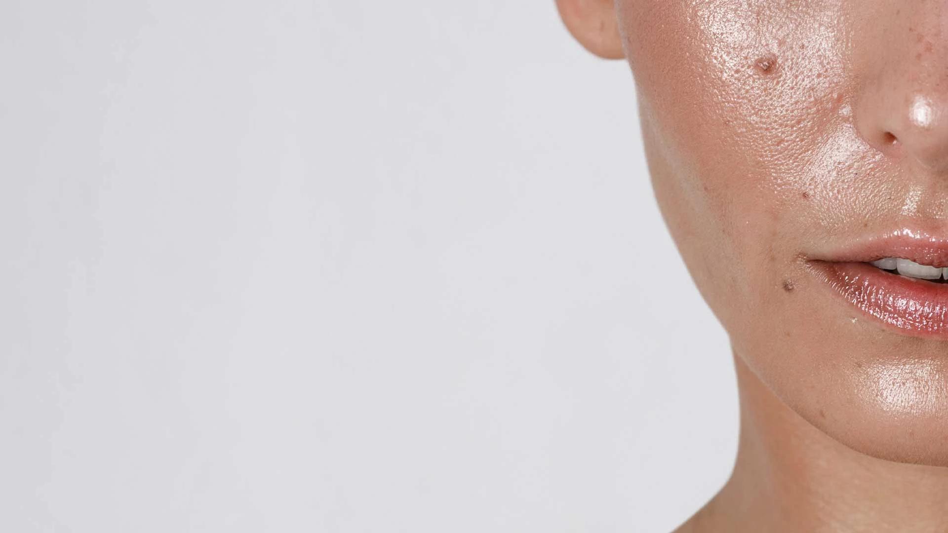 How to Treat Mouth Area Pigmentation Effectively