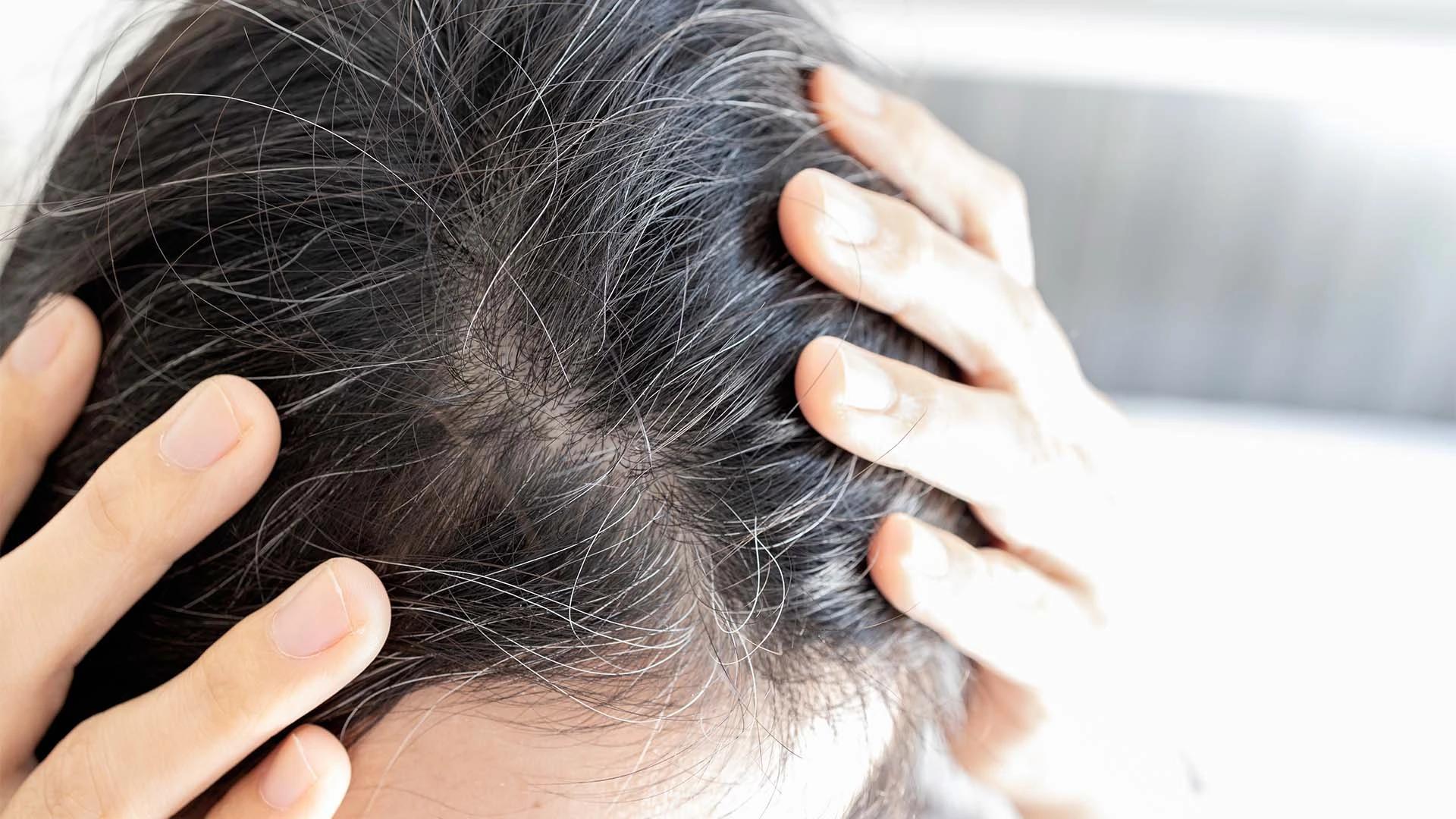 Renee Cover-Up Hair Powder: Quick Fix for Grey Roots