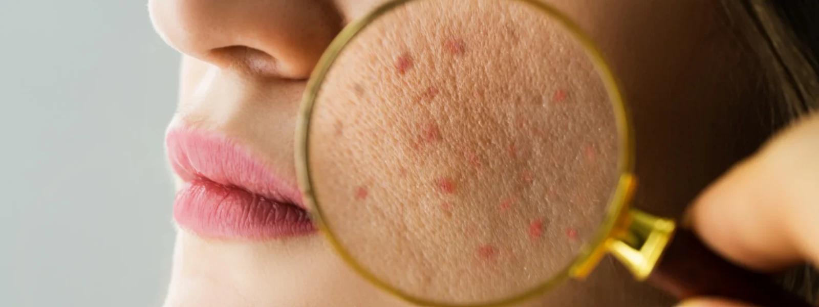 Alpha Arbutin Serum India FAQ: Your Guide to Brighter Skin