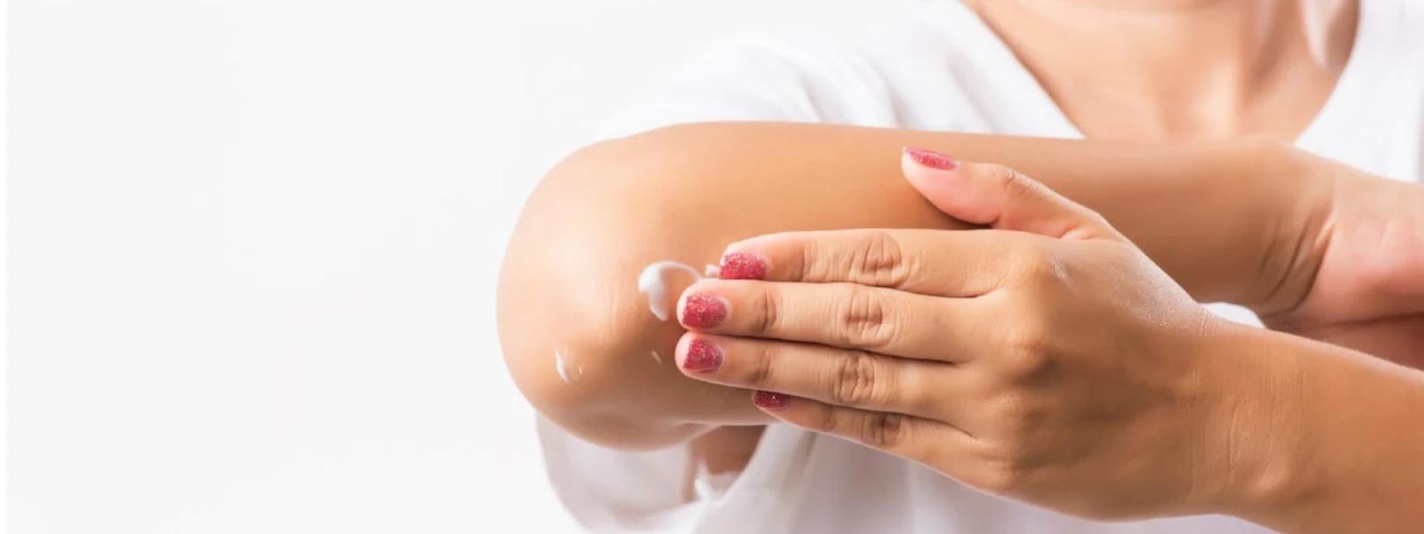 Body Melasma Remedies FAQ: All Your Questions Answered