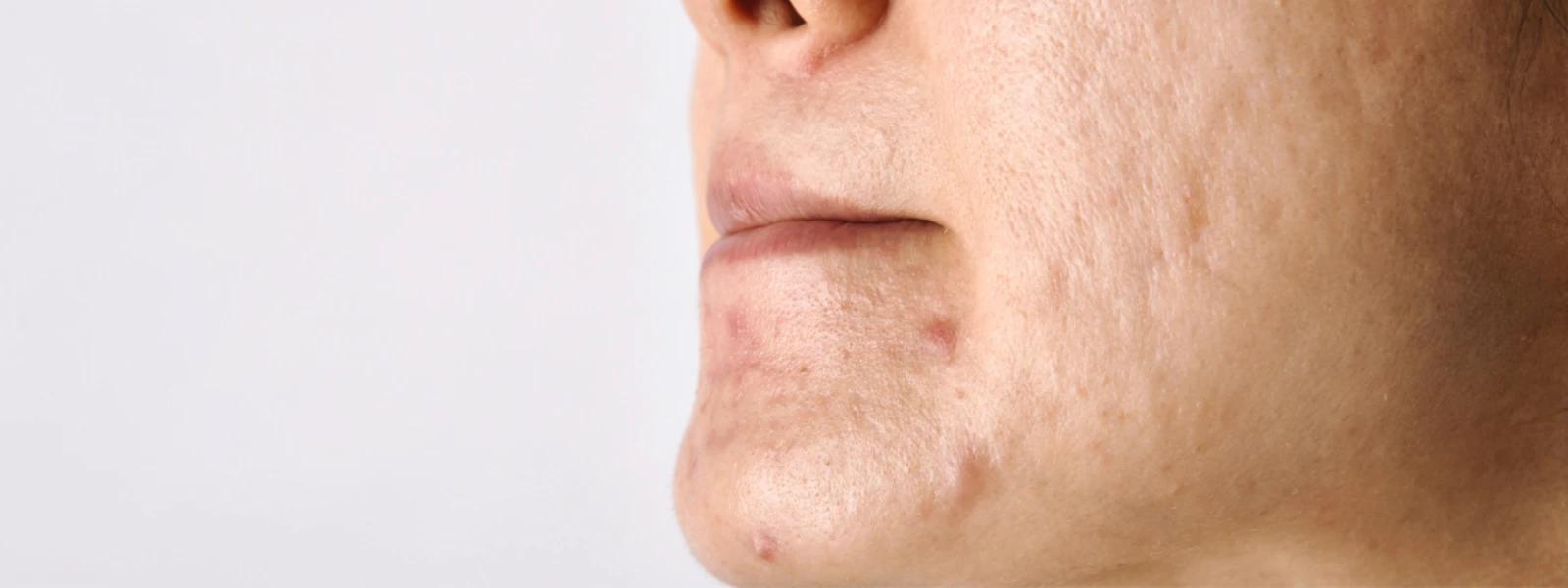 Causes of Uneven Skin Tone FAQ: Everything You Need to Know