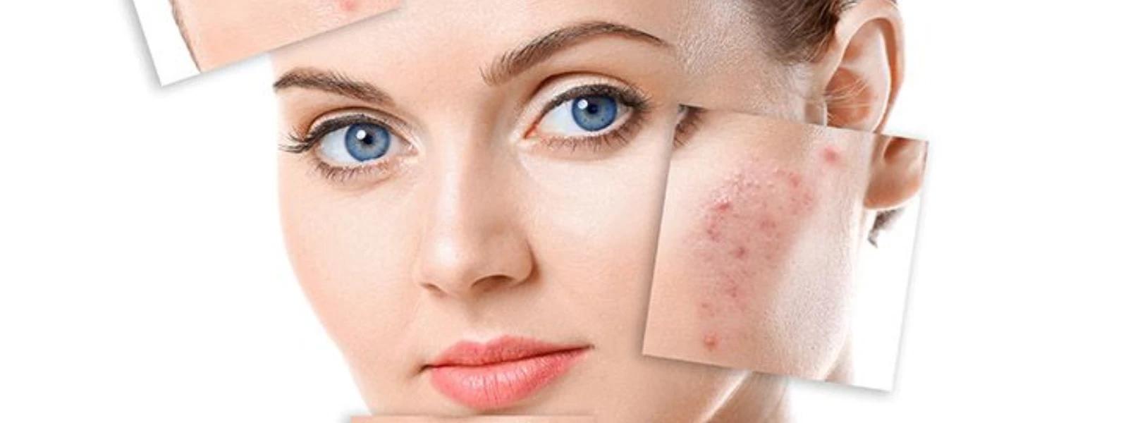Dark Spots Correction Home FAQ: Your Questions Answered