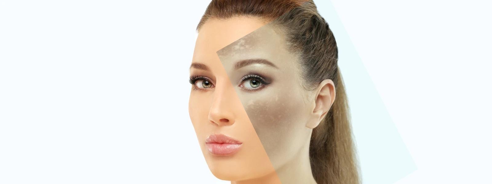 Even Skin Tone FAQ: Your Questions Answered