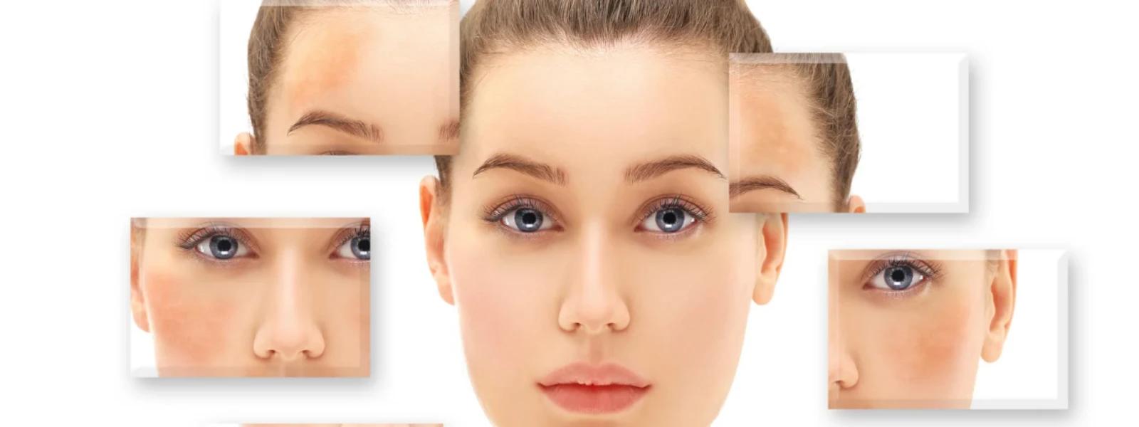Expert Insights: Unraveling the Causes of Skin Discoloration