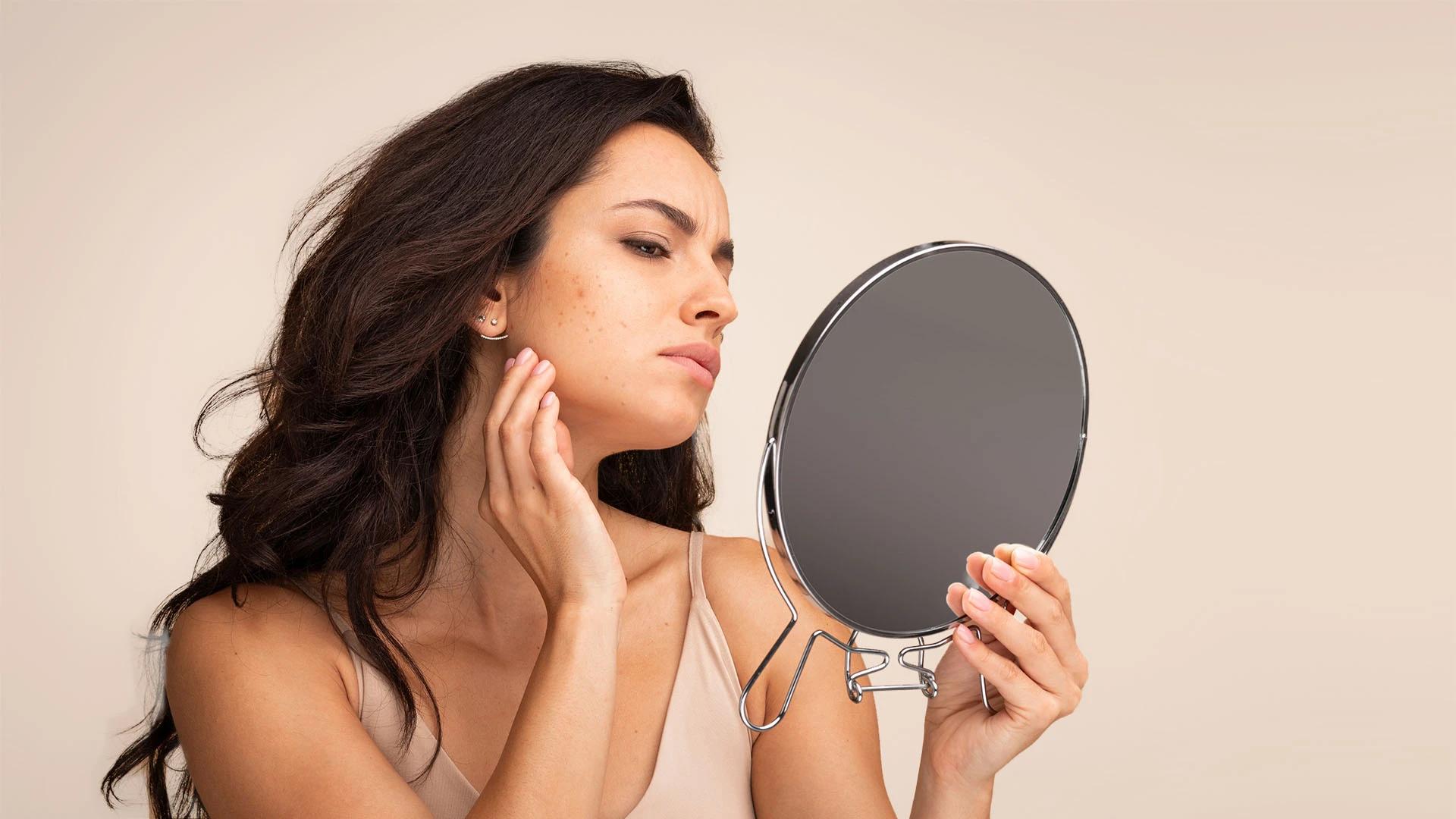 How Hormones Affect Skin: Understanding Your Skin Changes