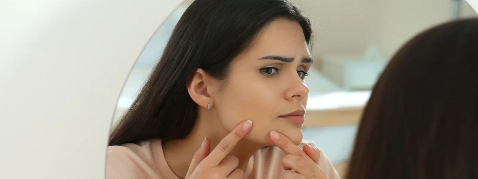 How to Fade Dark Skin Patches: Effective Hyperpigmentation Treatment