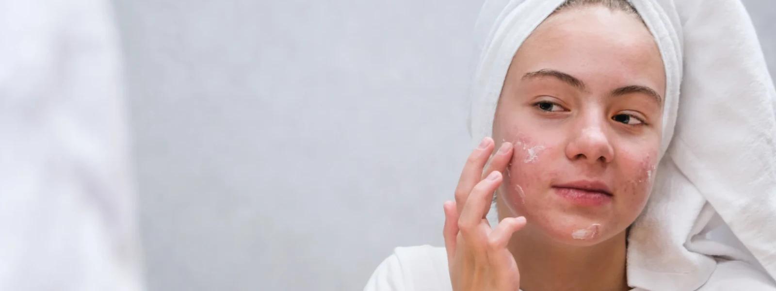 How to Prevent Dark Spots After Shaving for Smooth Skin