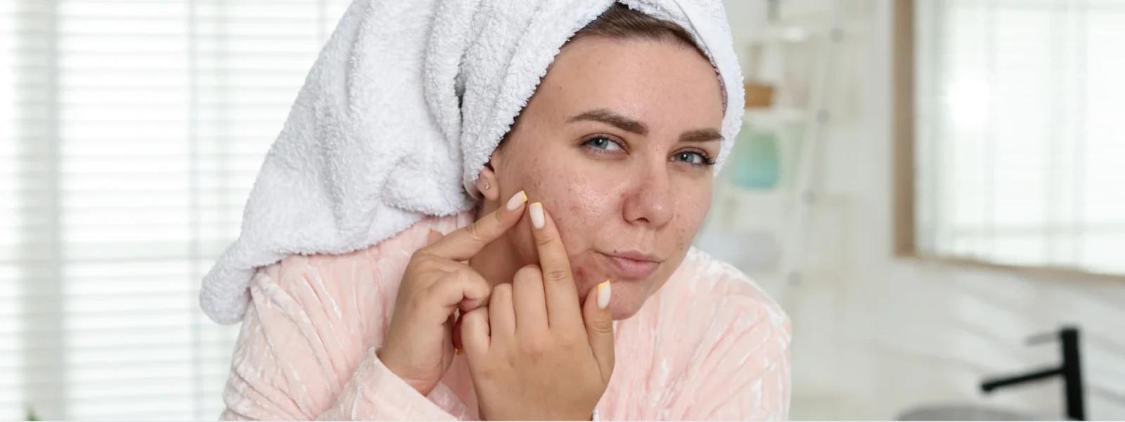 How to Reduce Dark Spots for Brighter, Even Skin Tone