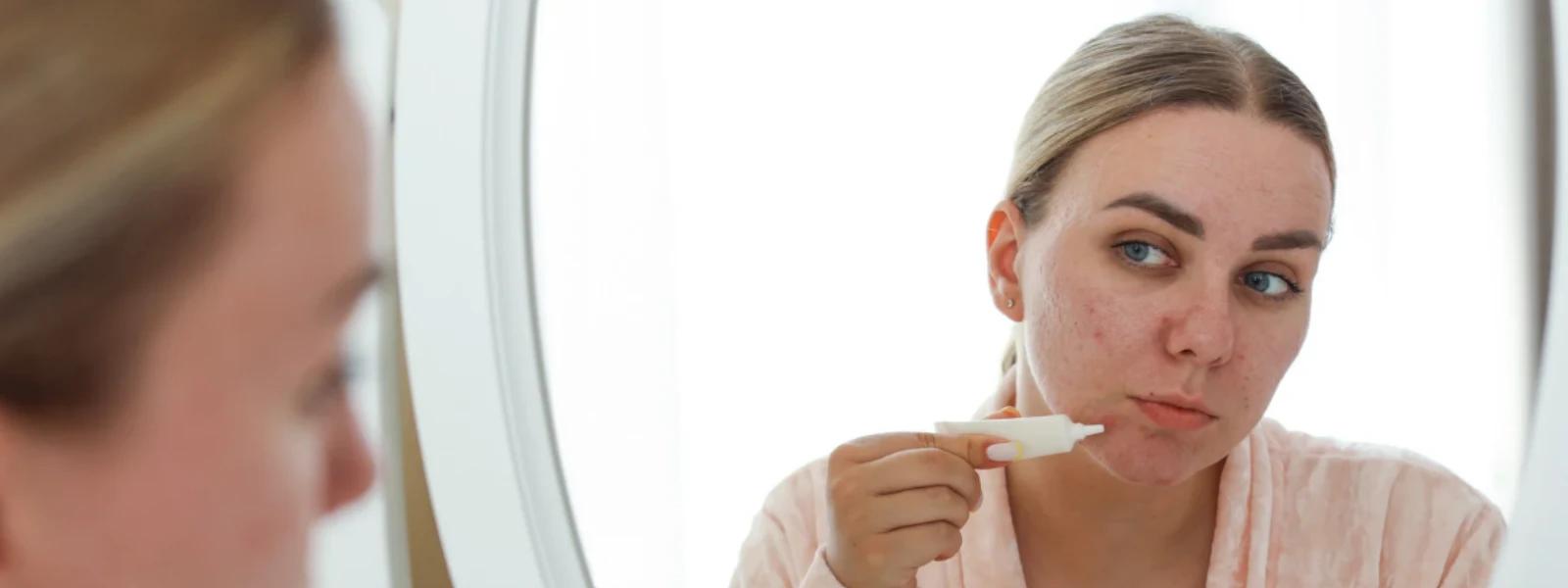 How to Reduce Dark Spots on Face Naturally