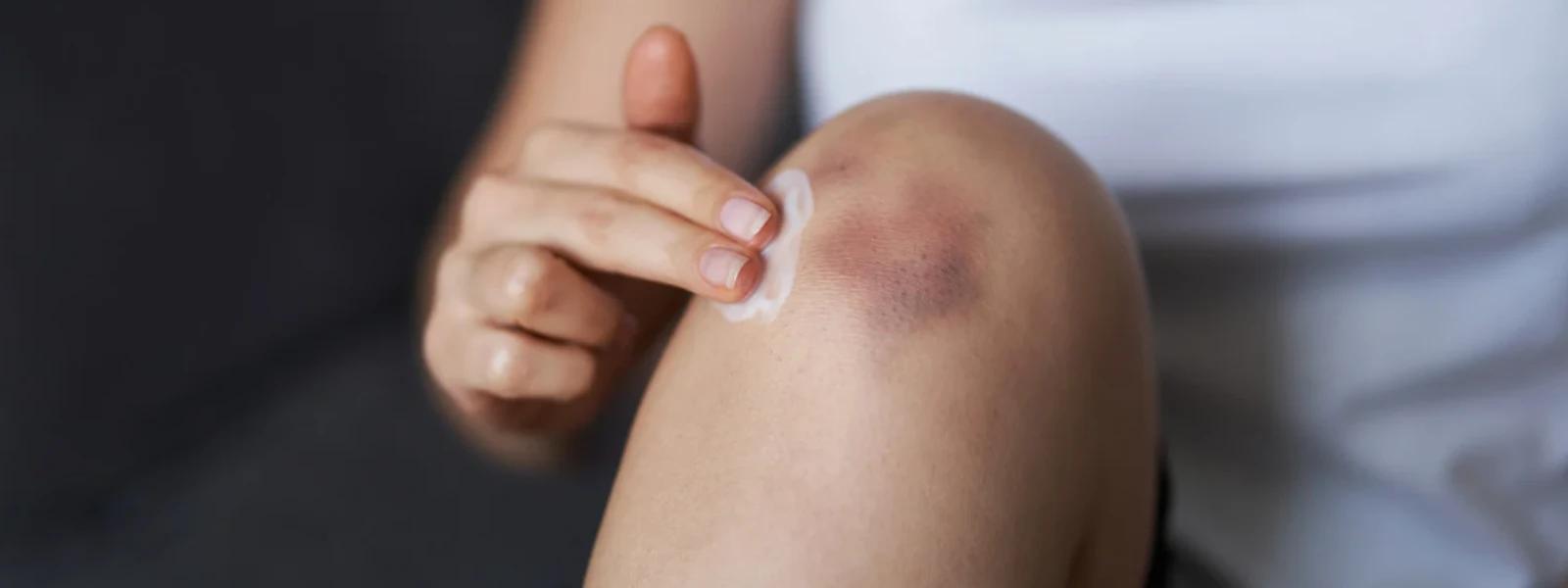 Knee Dark Spot Prevention Tips FAQ: Your Questions Answered