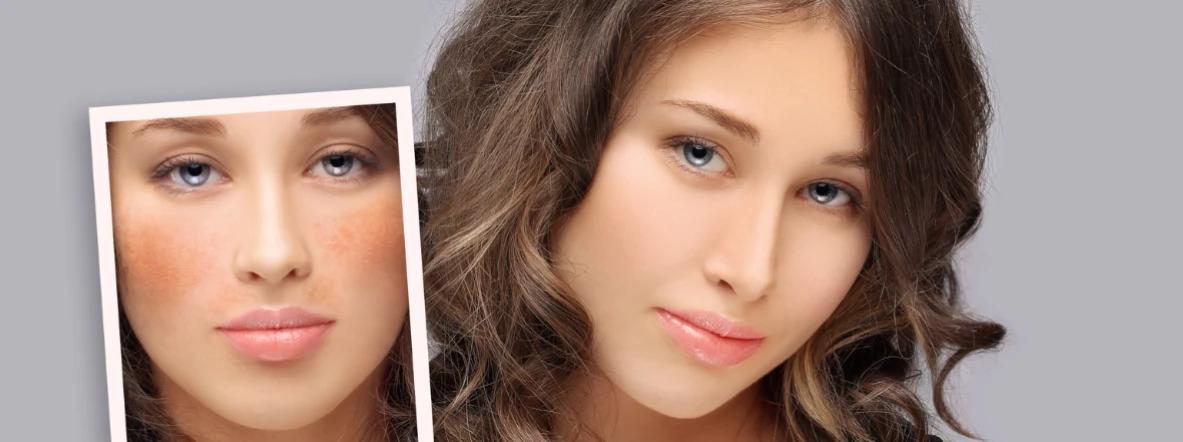Pigmentation Relief for Face FAQ: Your Questions Answered