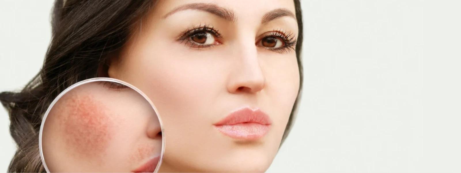 Understanding Melanin Skin: Your Questions Answered