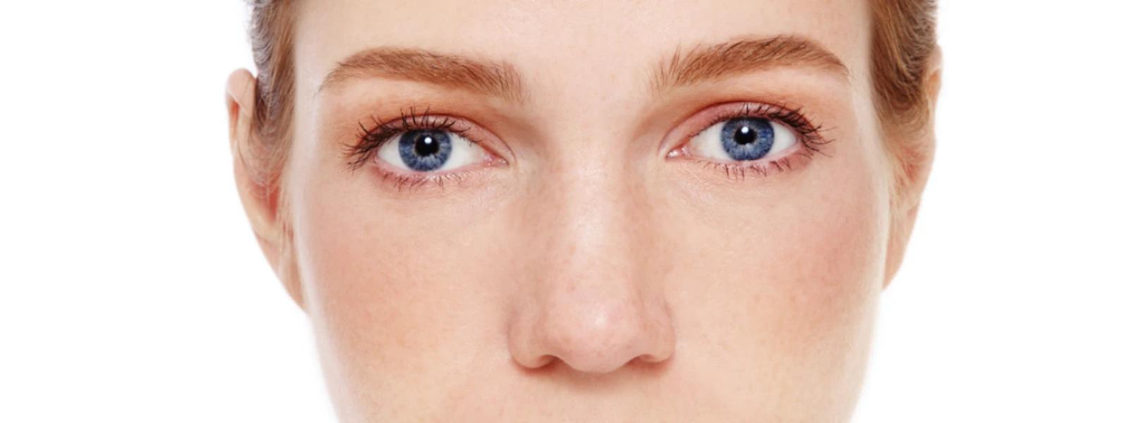 Understanding Skin Pigmentation Issues: A Complete Tutorial