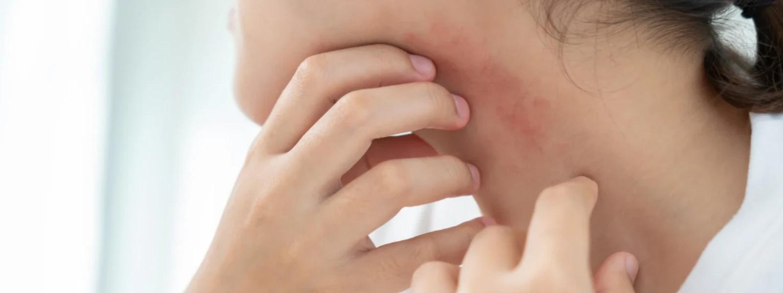 What Causes Body Dark Marks? Your FAQ Answered
